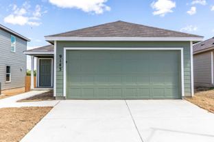 9143 Coronal Rings - Photo 1 of 1