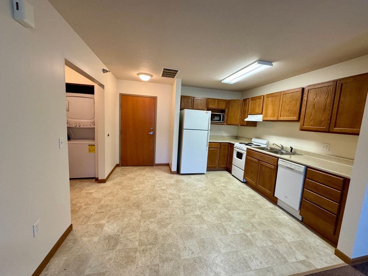 Welcome to Tippe River Downs - Photo 4 of 50