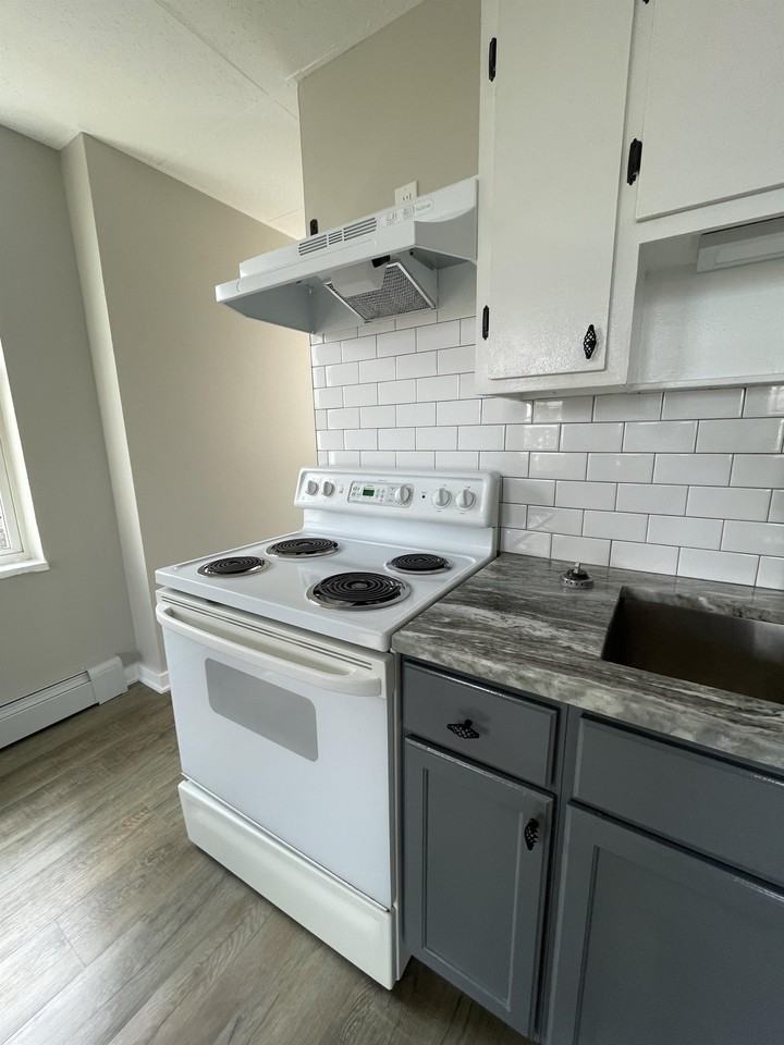 Burns - Photo 2 of 15