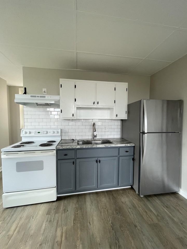 Burns - Photo 5 of 15