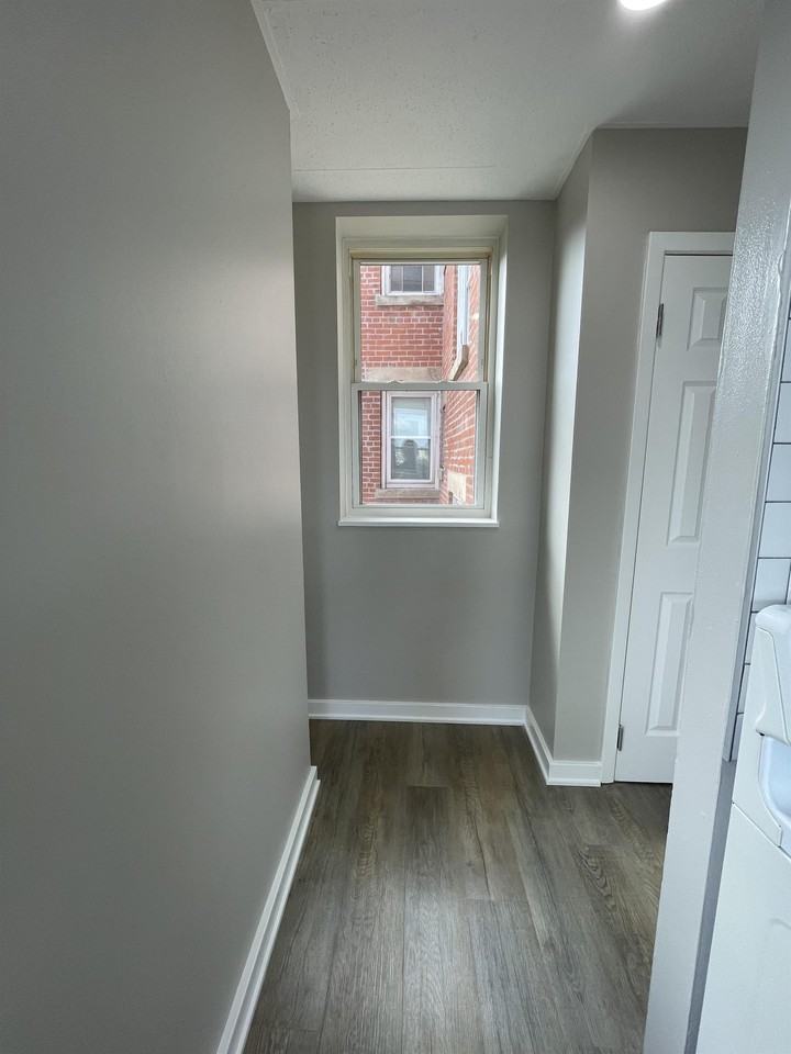 Burns - Photo 6 of 15