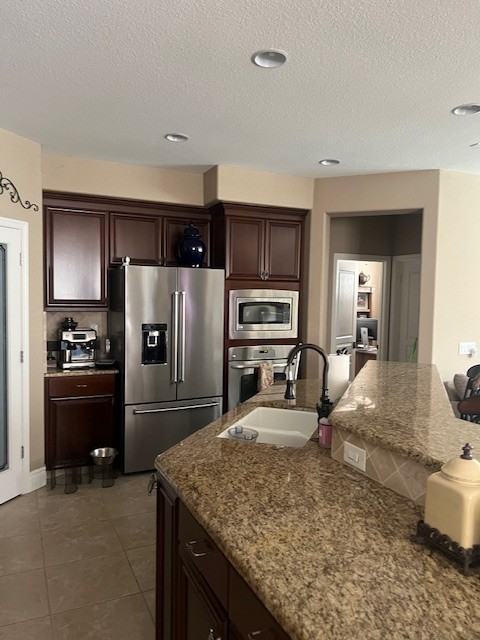 5828 Melones Way #NA - Photo 3 of 10