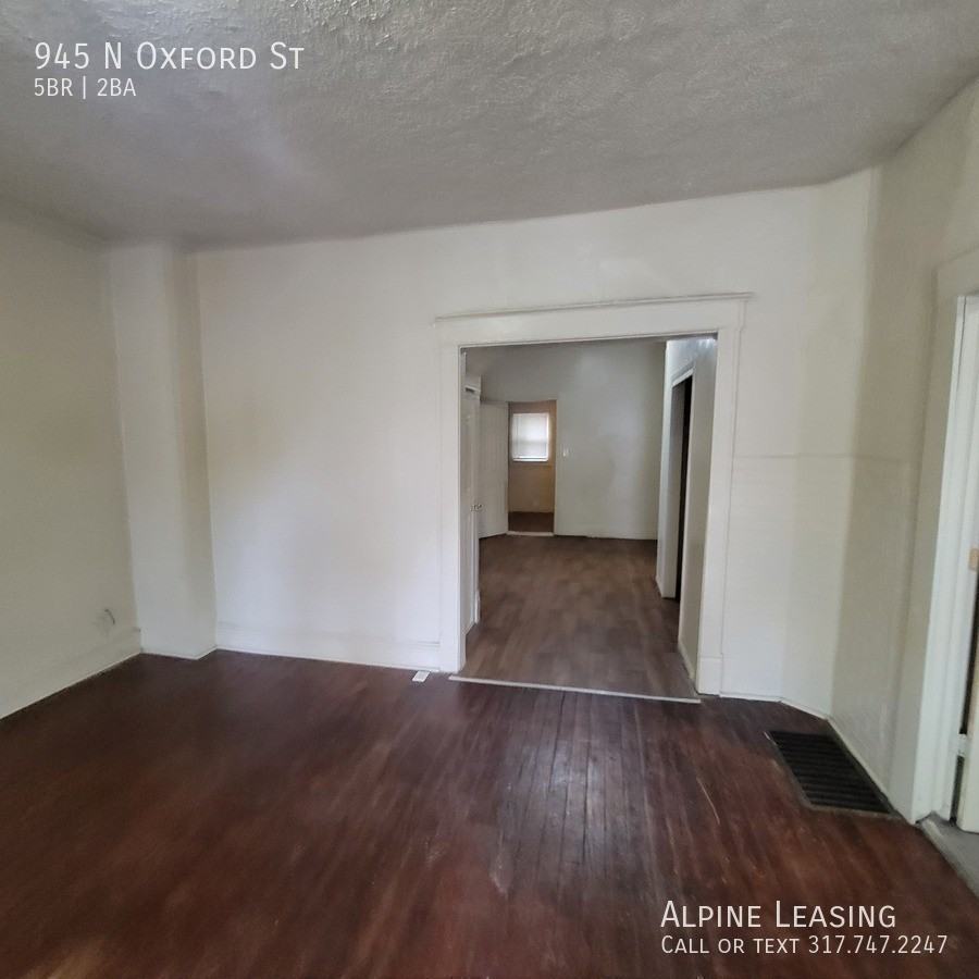 945 N Oxford St - Photo 5 of 7