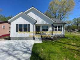 featured image of 561 20th Ave W