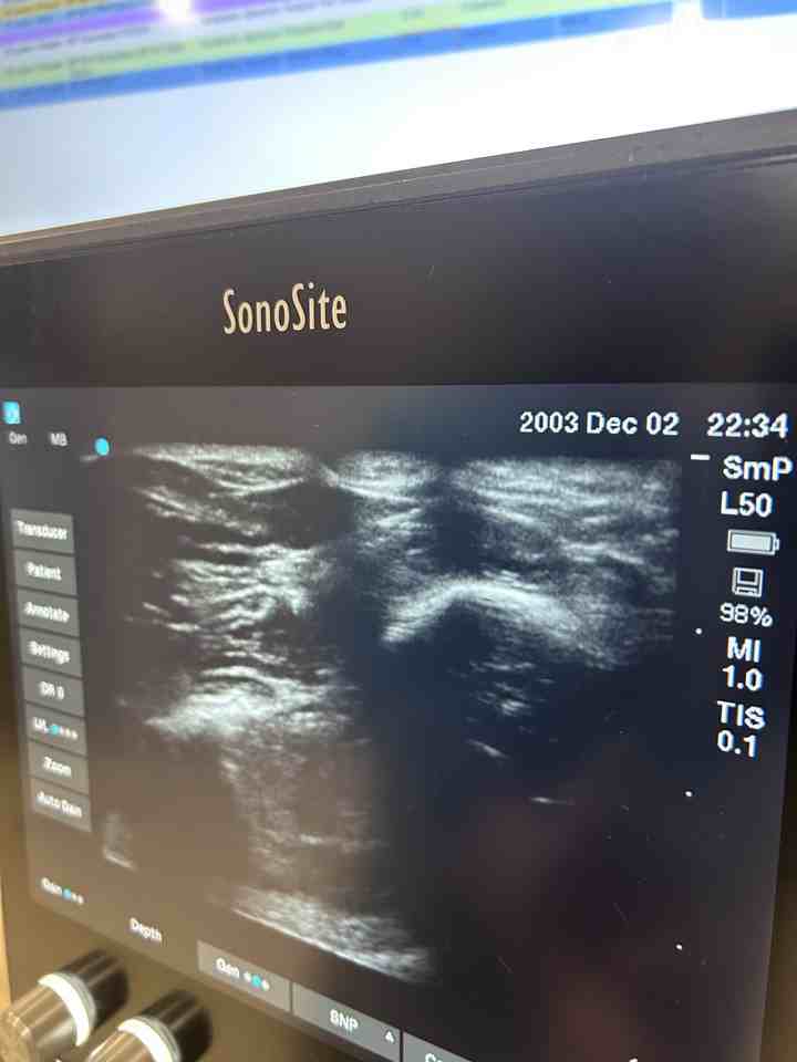 15101 Callohan Ct #15101 - Photo 3 of 8