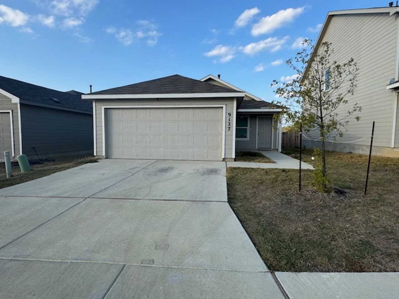 9127 Coronal Rings - Photo 3 of 15