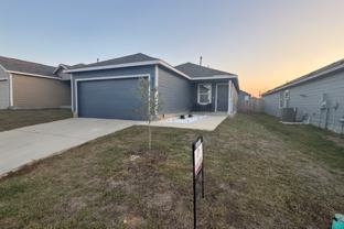 9142 Coronal Rings - Photo 1 of 1