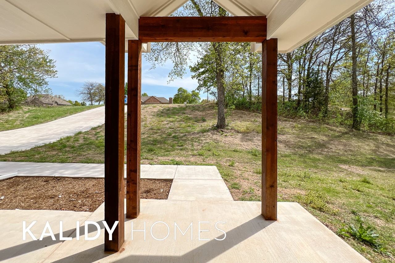 21315 Se 103rd St #1 - Photo 2 of 36