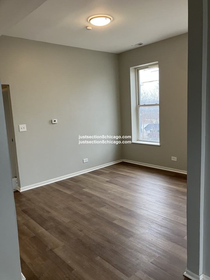 201 N North Laramie Ave. #2 - Photo 3 of 8