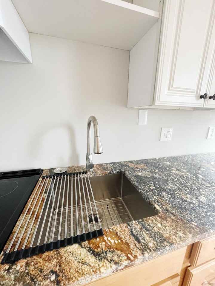 Burns - Photo 3 of 32