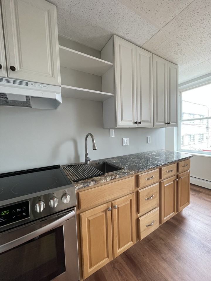 Burns - Photo 4 of 32