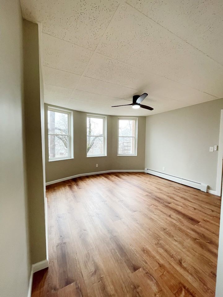 Burns - Photo 5 of 32