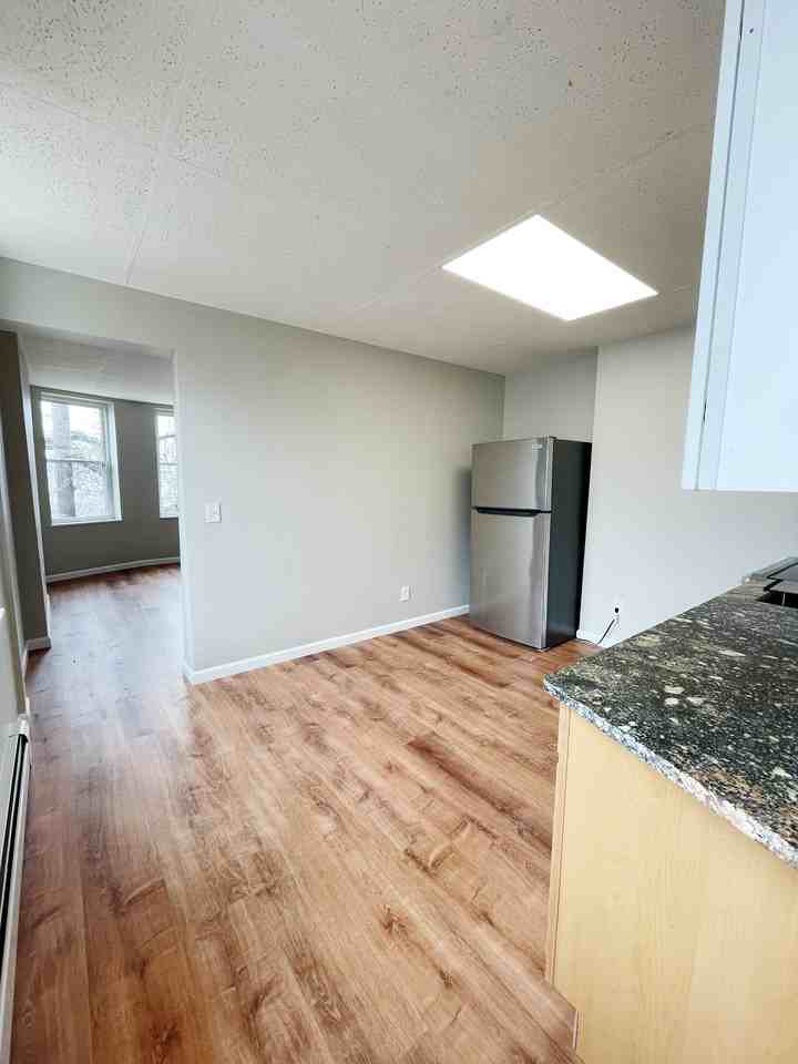 Burns - Photo 6 of 32