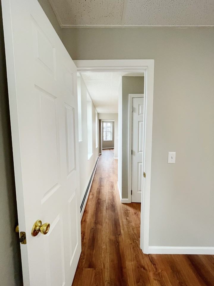 Burns - Photo 7 of 32