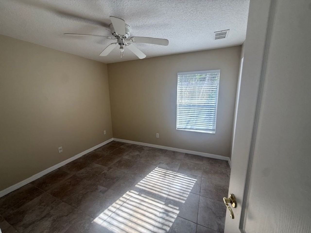 12B Bunker Knolls Ln - Photo 5 of 10