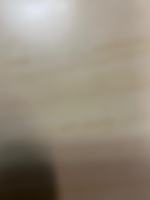 featured image of Ne 150th St