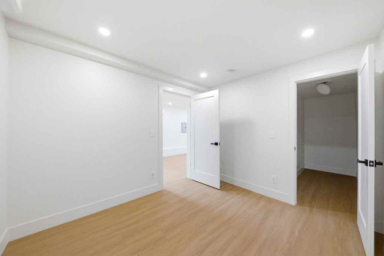 994 Noe St #2 - Photo 7 of 30