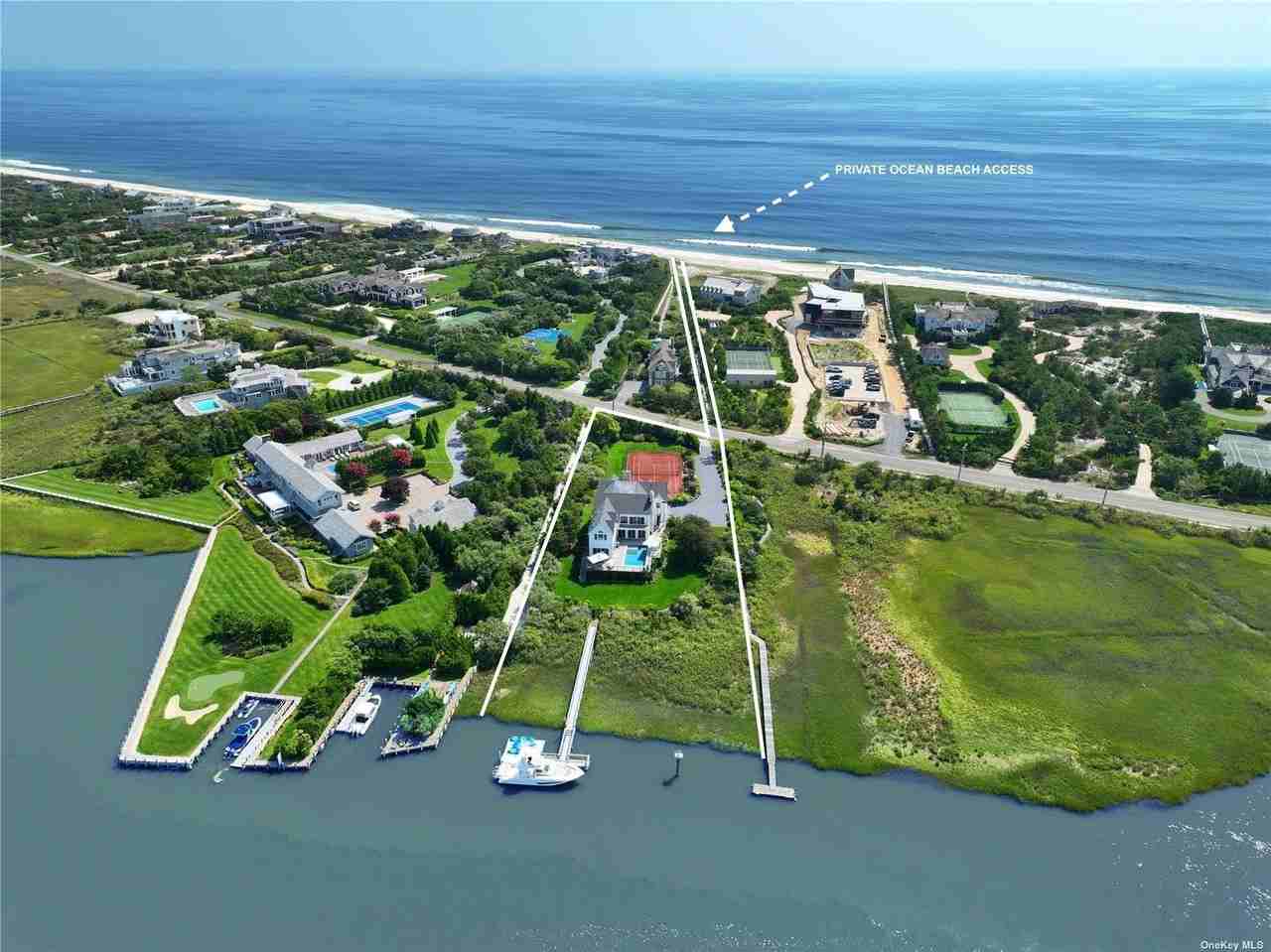 157 Dune Rd - Photo 5 of 36