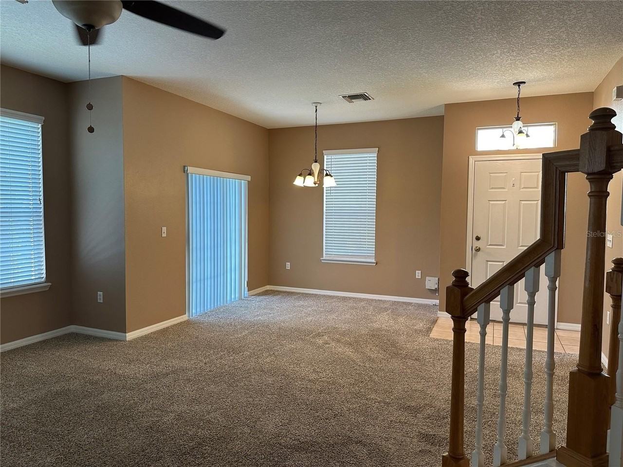 628 51st Ave N - Photo 7 of 28
