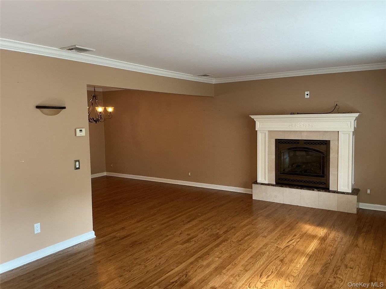 11 Frankel Rd - Photo 6 of 15