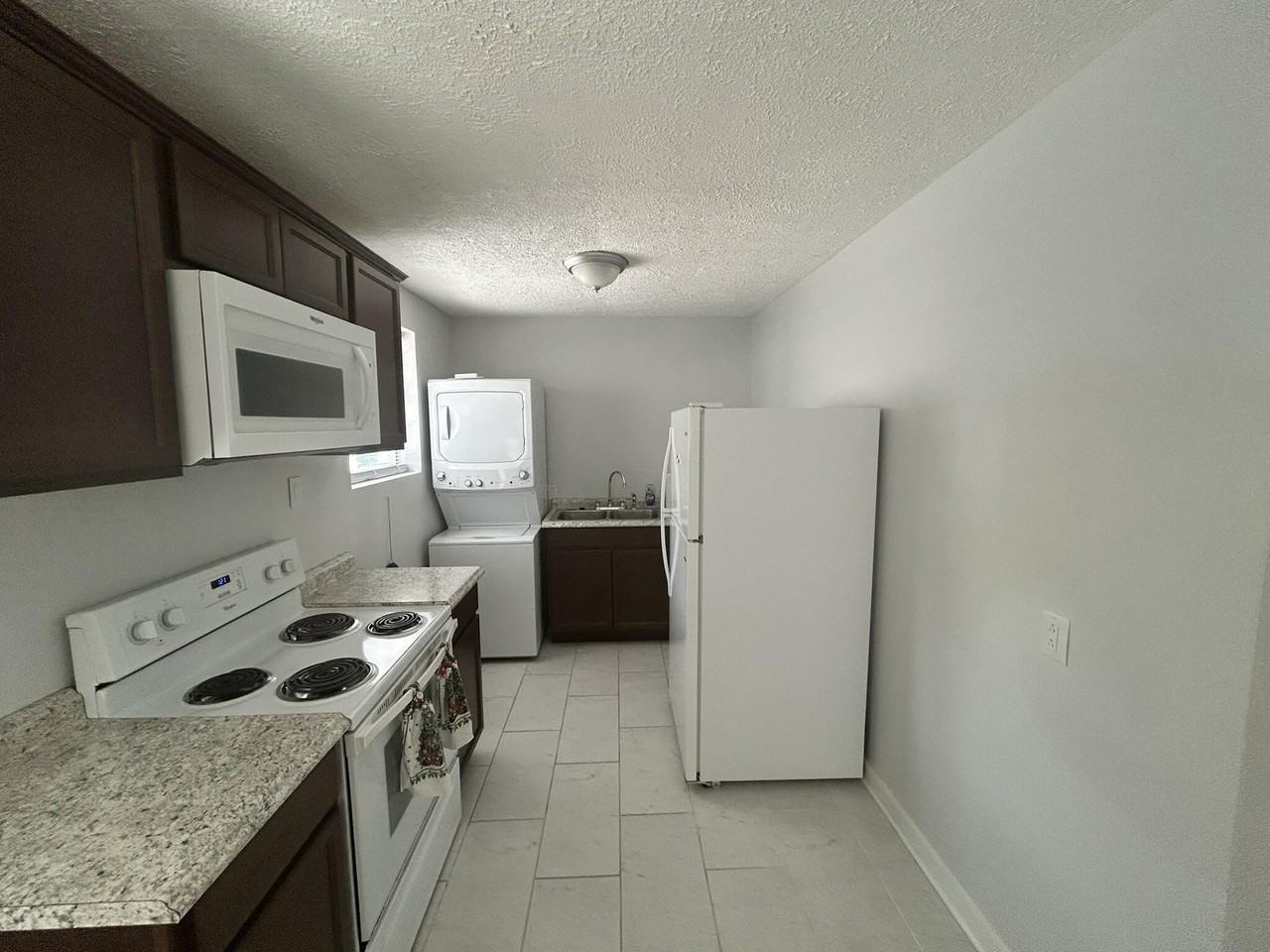1114 Cedar Ave S #B - Photo 3 of 7