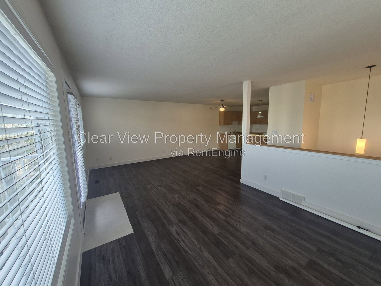304 Highlands Blvd W #4 - Photo 3 of 20
